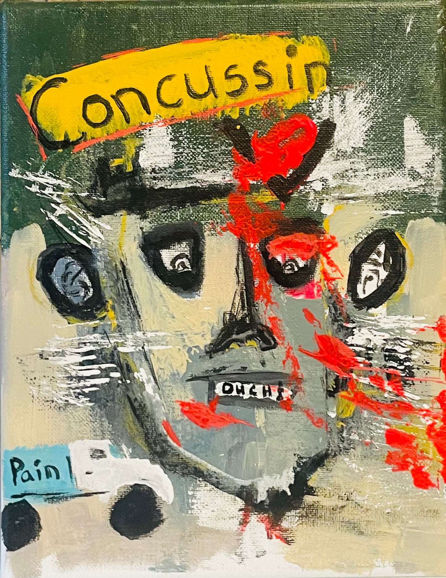 Concussin